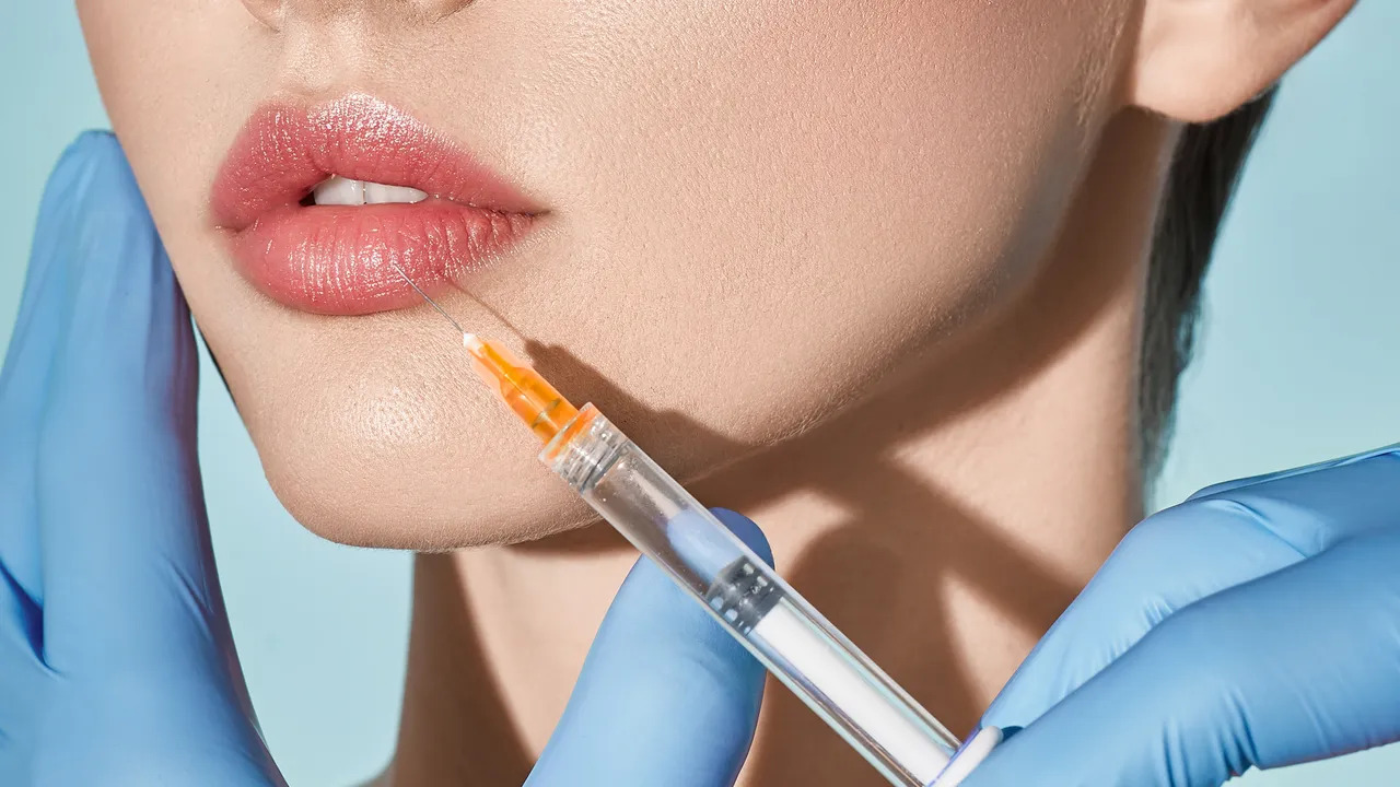 lip fillers